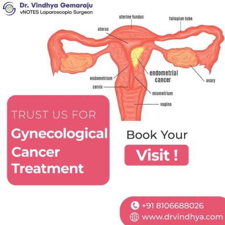 looking-for-the-best-gynecologist-in-hyderabad-consult-dr-vindhya-gemaraju-big-0