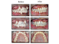 exceptional-dental-care-by-best-dental-clinic-in-bangalore-small-2