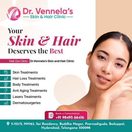 hair-loss-treatment-in-peerzadiguda-laser-hair-removal-clinic-in-hyderabad-big-0