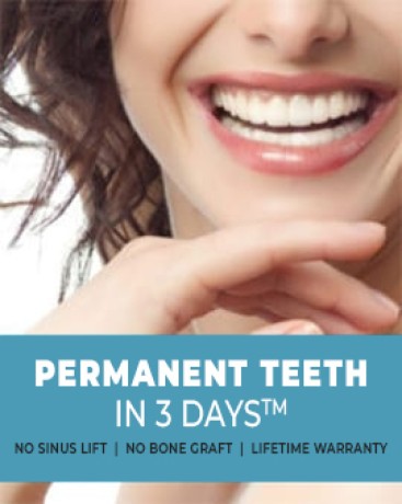 permanent-teeth-implants-in-india-big-0