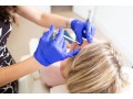 the-comprehensive-guide-to-dental-botox-implants-in-uk-small-0