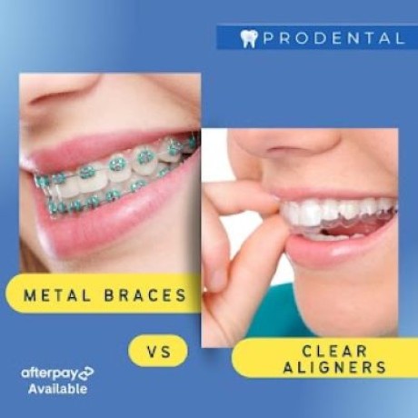 get-a-free-quote-at-prodental-clinic-the-top-dentist-in-baulkham-hills-sydney-big-0