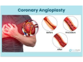 tavr-specialist-in-india-dr-ravinder-singh-rao-small-0