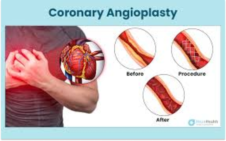 tavr-specialist-in-india-dr-ravinder-singh-rao-big-0